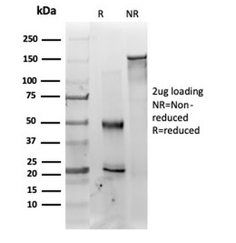 MED22 (Transcription Factor) Antibody