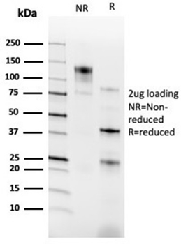 RXRG / NR2B3 (Transcription Factor) Antibody