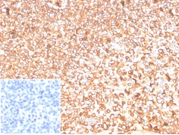 Beta-Actin (ACTB) Antibody