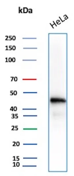 Beta-Actin (ACTB) Antibody