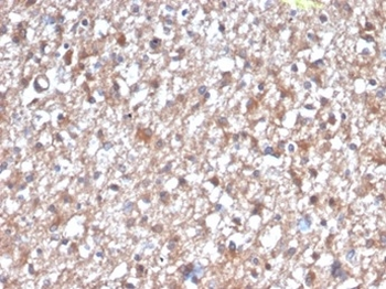 PRKCI Antibody