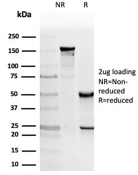 PRKCI Antibody