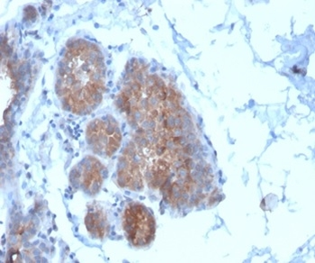 Migfilin-1 / FBLIM1 Antibody