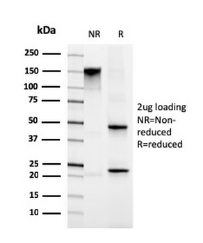 Migfilin-1 / FBLIM1 Antibody