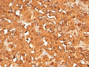 Recombinant ACTH (Adrenocorticotrophic Hormone) (Pituitary Marker) Antibody