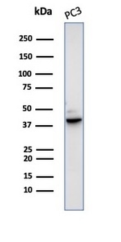 SERPINB5 Antibody