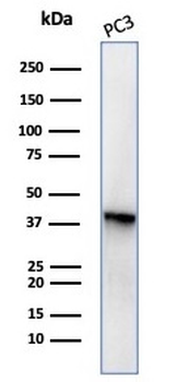 SERPINB5 / Maspin Antibody