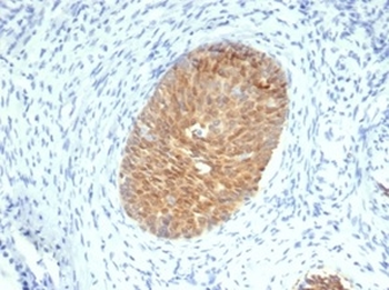 SERPINB5 / Maspin Antibody