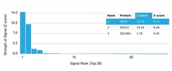 SOX4 (Master Regulator of Epithelial-Mesenchymal Transition) Antibody