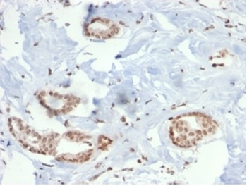 SOX4 (Master Regulator of Epithelial-Mesenchymal Transition) Antibody