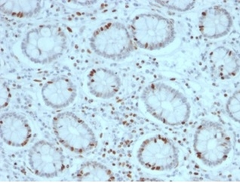 SOX4 (Master Regulator of Epithelial-Mesenchymal Transition) Antibody