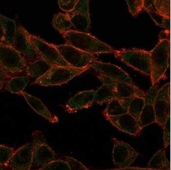 SOX4 (Master Regulator of Epithelial-Mesenchymal Transition) Antibody
