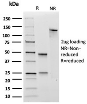 SOX4 (Master Regulator of Epithelial-Mesenchymal Transition) Antibody