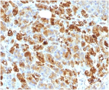 SERPINA3 Antibody