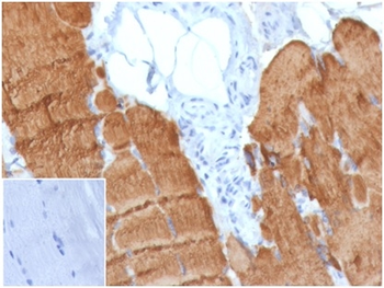 ACTA1 Antibody