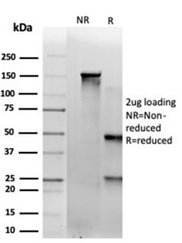 SAMD4B (Transcription Factor) Antibody