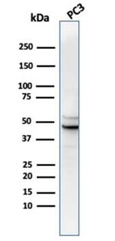 Recombinant Ornithine Decarboxylase-1 (ODC-1) Antibody