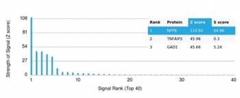 Natriuretic Peptide B / NPPB Antibody
