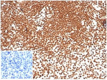 Recombinant Nucleophosmin (Acute Myeloid Leukemia Marker) Antibody