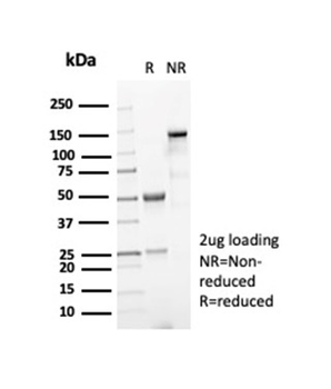 Recombinant Nucleophosmin (Acute Myeloid Leukemia Marker) Antibody