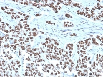 NFIA / NF1A (Nuclear Factor 1A) (Transcription Factor) Antibody