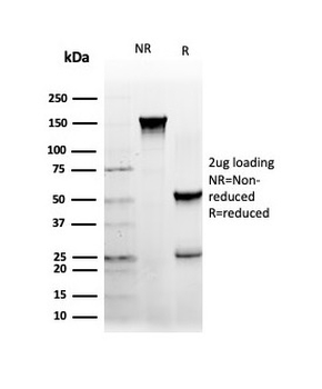 NFIA / NF1A (Nuclear Factor 1A) (Transcription Factor) Antibody