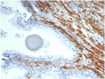 Recombinant Smooth MuscleMyosin Heavy Chain (SM-MHC) (Leiomyosarcoma & Myoepithelial Cell Marker) Antibody