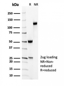Recombinant Smooth MuscleMyosin Heavy Chain (SM-MHC) (Leiomyosarcoma & Myoepithelial Cell Marker) Antibody