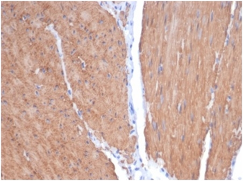 Recombinant Smooth MuscleMyosin Heavy Chain (SM-MHC) (Leiomyosarcoma & Myoepithelial Cell Marker) Antibody