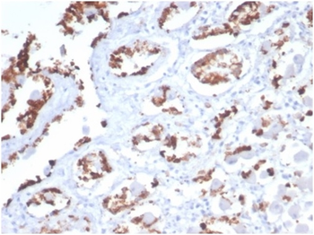 Recombinant MUC5AC (Mucin 5AC / Gastric Mucin) Antibody