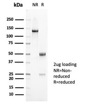 Recombinant MUC5AC (Mucin 5AC / Gastric Mucin) Antibody