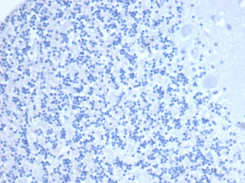 CD10 (Membrane Metalloendopeptidase) Antibody