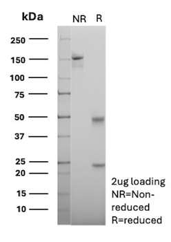 CD10 (Membrane Metalloendopeptidase) Antibody