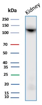 CD10 (Membrane Metalloendopeptidase) Antibody