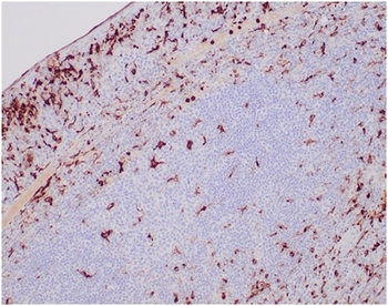 LYZ Antibody