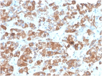 Recombinant LH-beta (Luteinizing Hormone-beta) Antibody