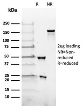 Recombinant LH-beta (Luteinizing Hormone-beta) Antibody