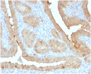 Galectin-3 (LGALS3) (Thyroid Cell Marker) Antibody