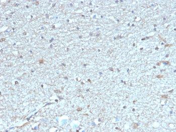 Leptin Receptor (LEPR) / Ob-R / CD295 Antibody