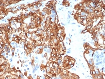 KRT14 Antibody