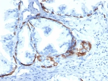KRT14 Antibody