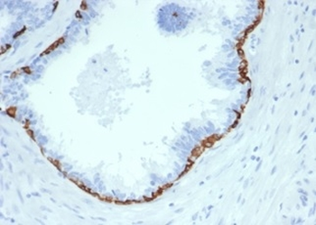 Recombinant Cytokeratin 14 (KRT14) (Squamous Cell Marker) Antibody
