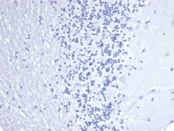 Recombinant Cytokeratin 14 (KRT14) (Squamous Cell Marker) Antibody