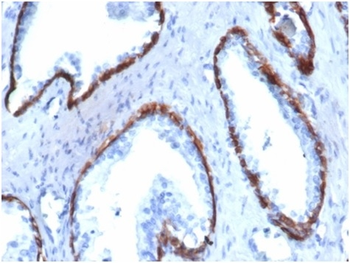 KRT14 Antibody