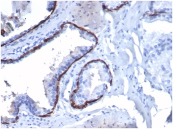 KRT14 Antibody