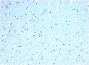 Recombinant Inhibin, alpha (INHA) (Gonadal Cell Marker) Antibody