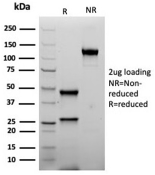 Recombinant Inhibin, alpha (INHA) (Gonadal Cell Marker) Antibody