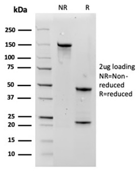 Aquaporin 4 (AQP4) Antibody