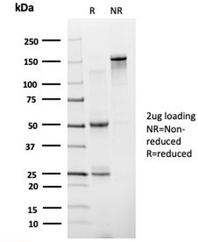 ZNF81 / Zinc finger protein 81 (Transcription Factor) Antibody