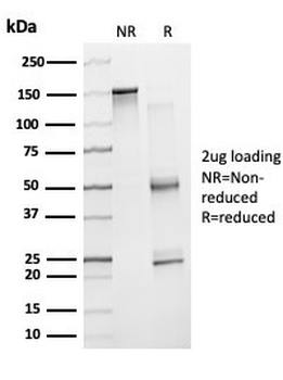 ZNF81 / Zinc finger protein 81 (Transcription Factor) Antibody